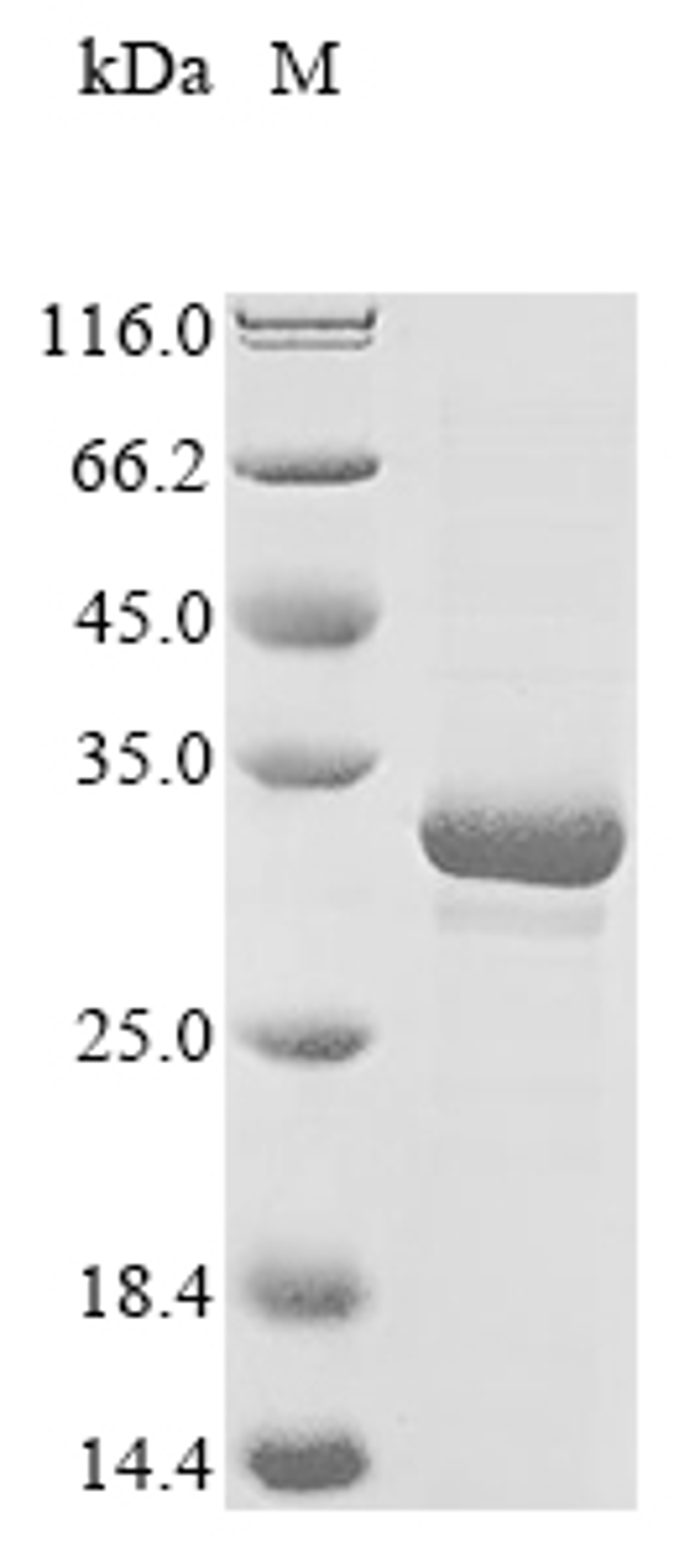 (Tris-Glycine gel) Discontinuous SDS-PAGE (reduced) with 5% enrichment gel and 15% separation gel.