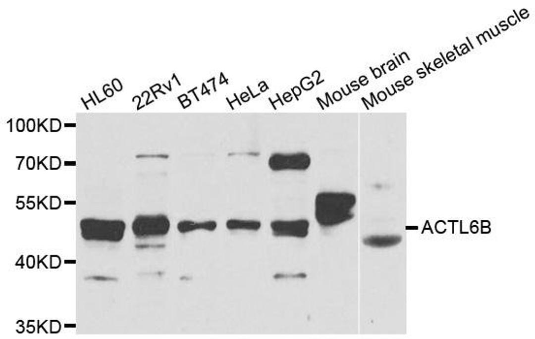 Western blot analysis of extracts of various cell lines using ACTL6 antibody