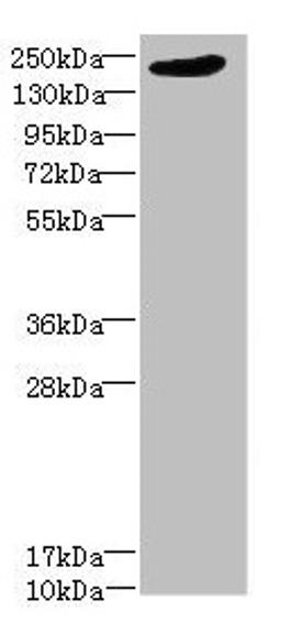 Western blot. All lanes: LRP4 antibody at 1.39µg/ml + PC-3 whole cell lysate. Secondary. Goat polyclonal to rabbit IgG at 1/10000 dilution. Predicted band size: 213 kDa. Observed band size: 213 kDa
