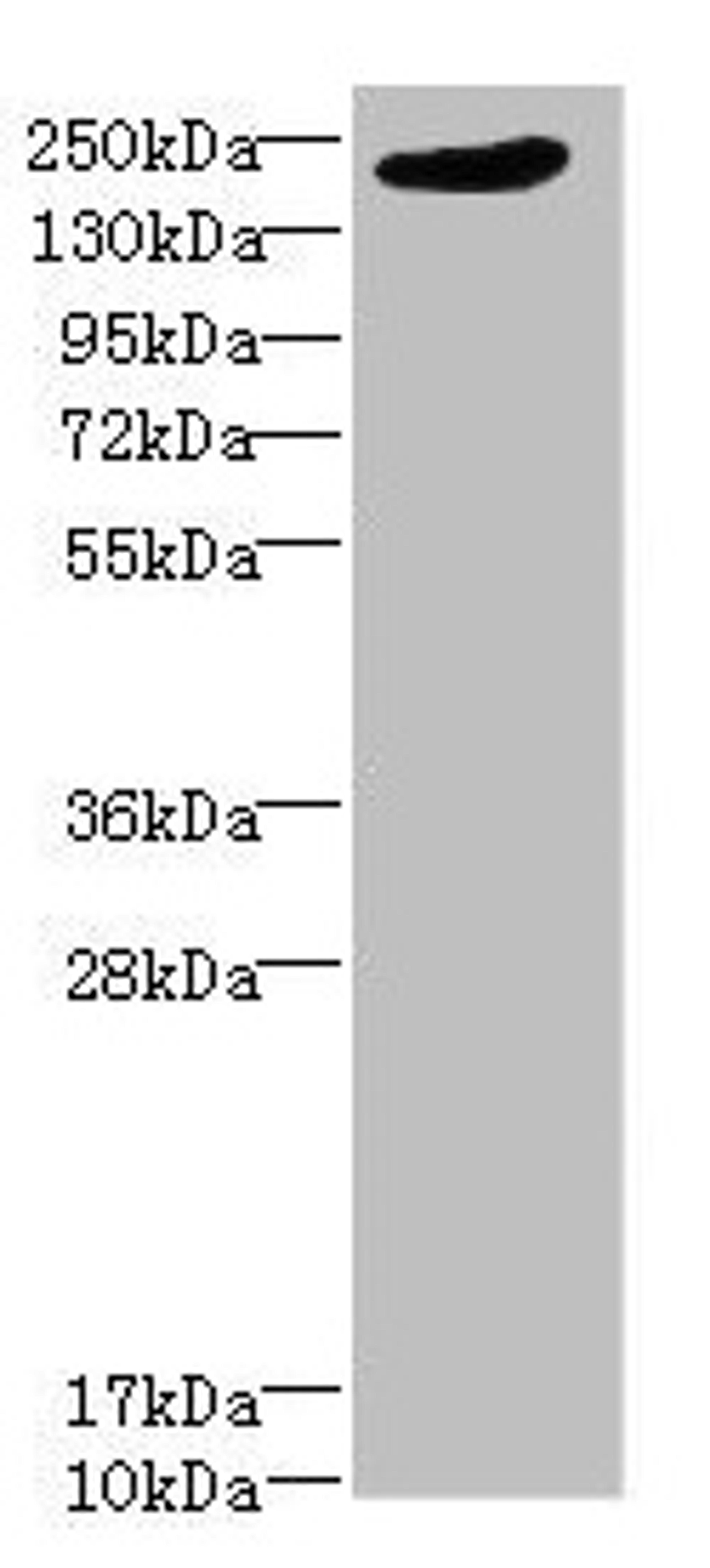 Western blot. All lanes: LRP4 antibody at 1.39µg/ml + PC-3 whole cell lysate. Secondary. Goat polyclonal to rabbit IgG at 1/10000 dilution. Predicted band size: 213 kDa. Observed band size: 213 kDa