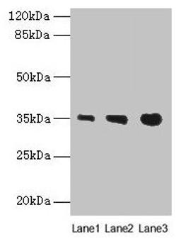 Western blot. All lanes: PVRIG antibody at 4µg/ml. Lane 1: Mouse liver tissue. Lane 2: Mouse kidney tissue. Lane 3: Mouse heart tissue. Secondary. Goat polyclonal to rabbit IgG at 1/10000 dilution. Predicted band size: 35 kDa. Observed band size: 35 kDa