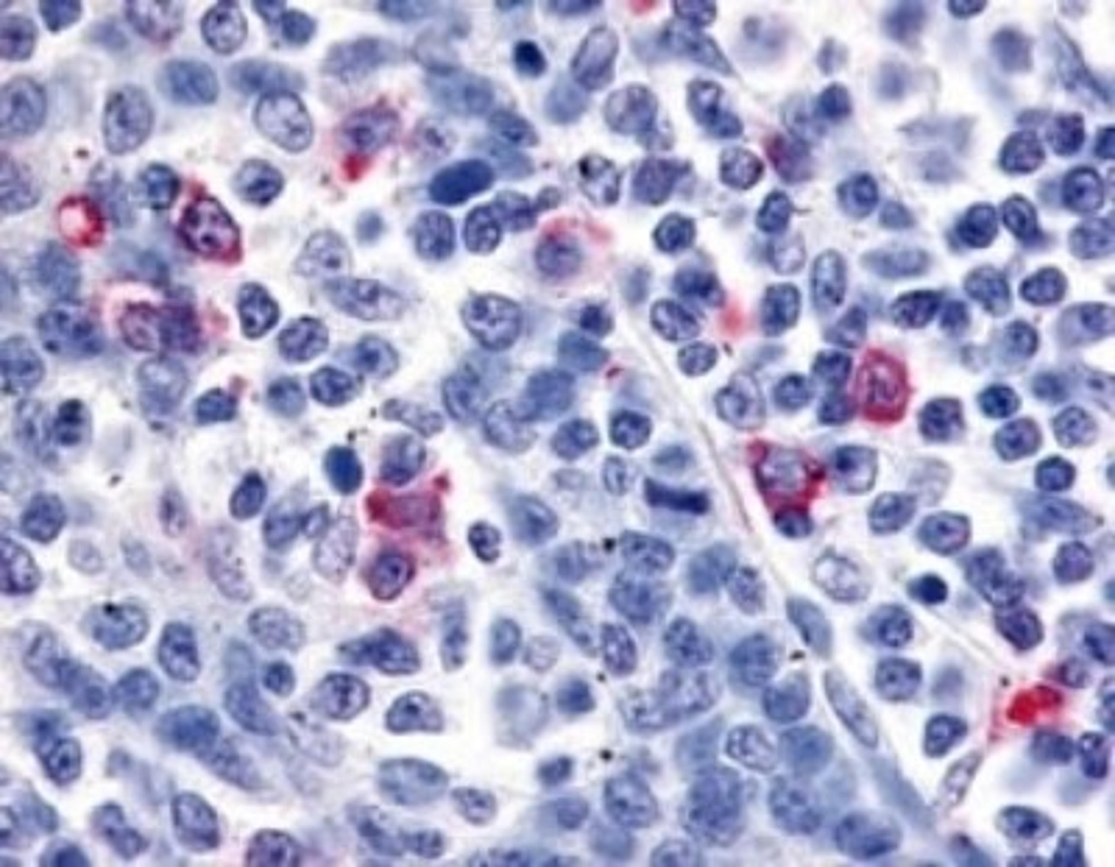 Immunohistochemistry-Paraffin: CXCR6 Antibody [NLS1102] - Analysis of anti-CXCR6 antibody with tonsil, interfollicular zone at 6.8 ug/ ml.