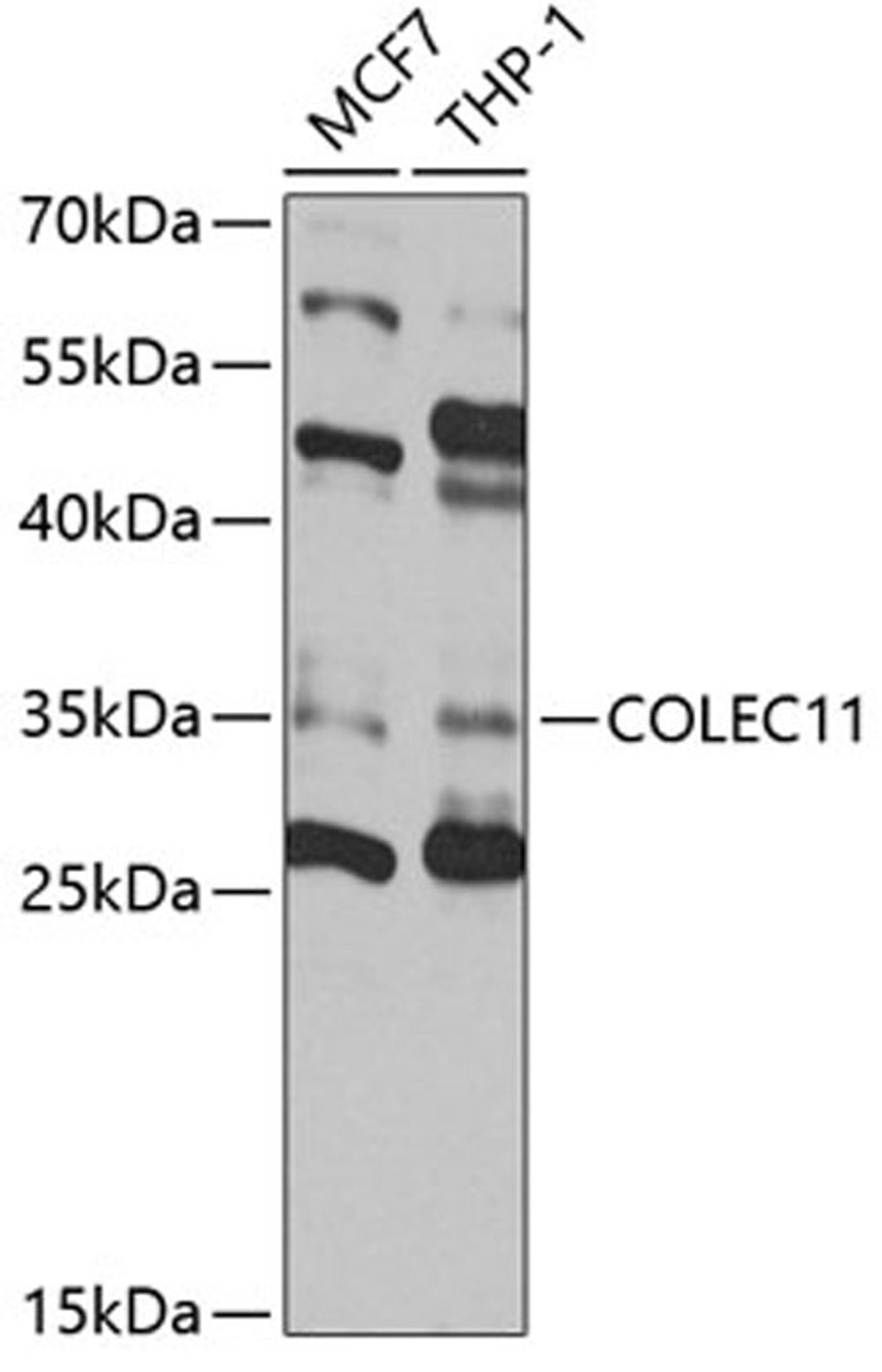 Western blot - COLEC11 antibody (A4955)