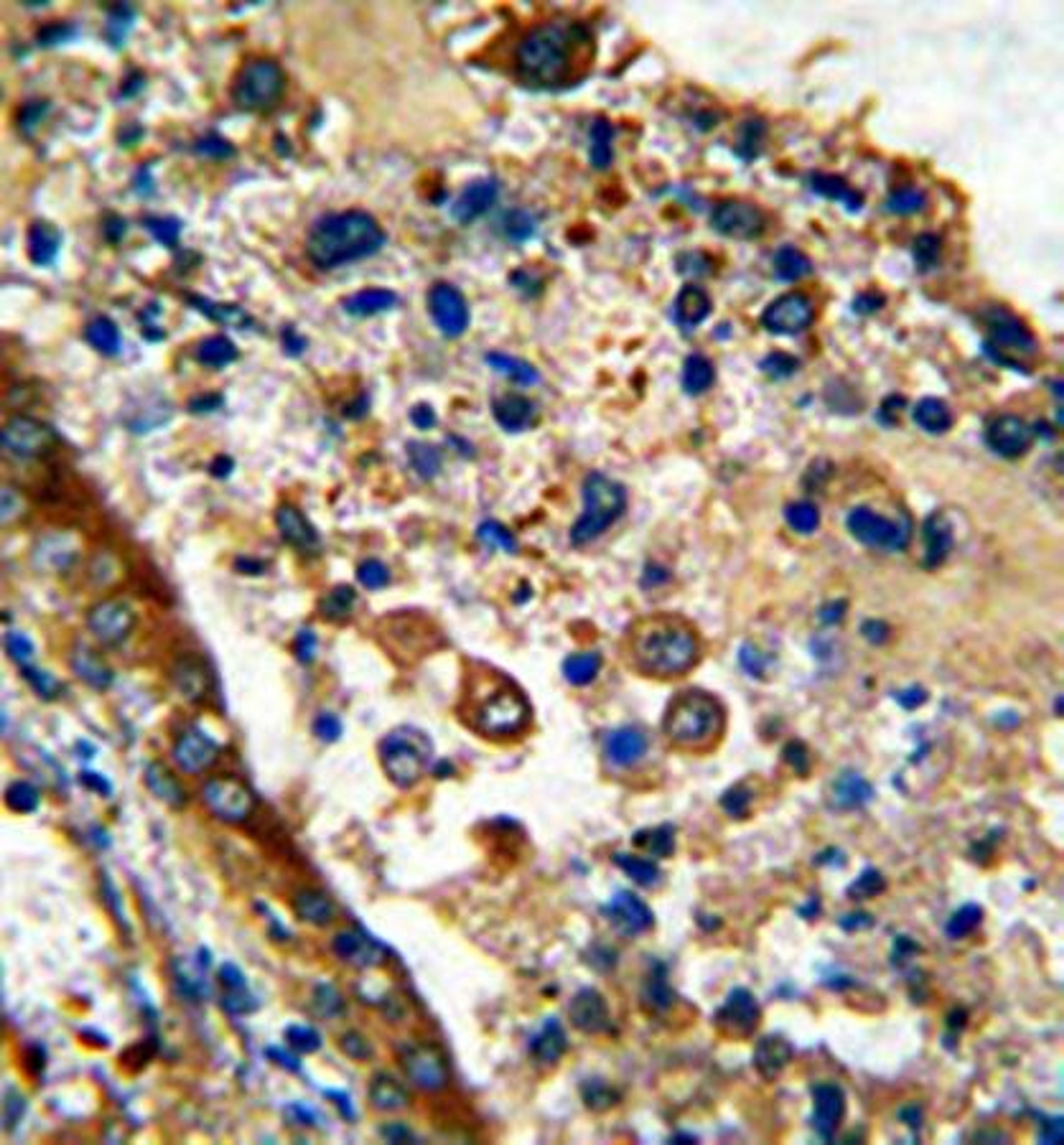 IHC-P human cerebellum tissue(GARP antibody at 1:200)