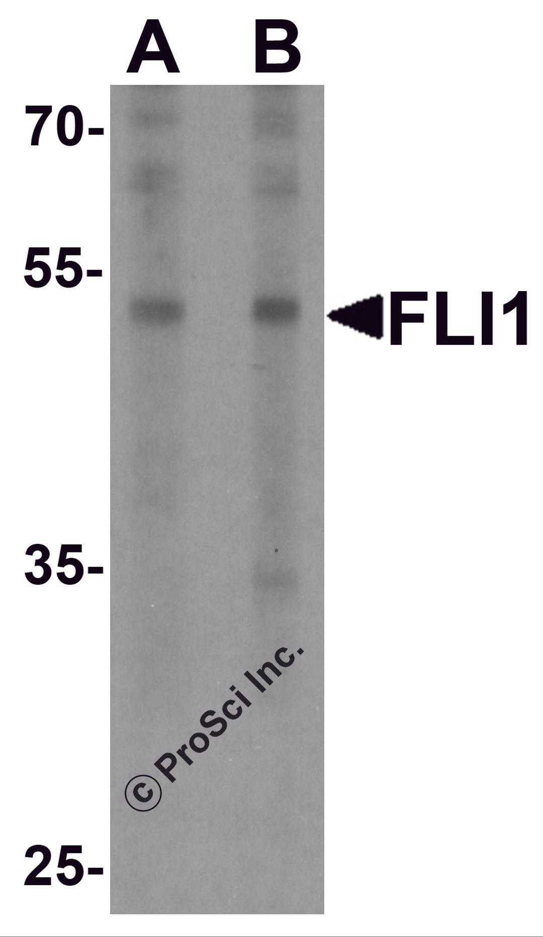 Western blot analysis of FLI1 in Jurkat cell lysate with FLI1 antibody at (A) 0.5 and (B) 1 μg/ml.
