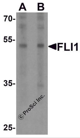 Western blot analysis of FLI1 in Jurkat cell lysate with FLI1 antibody at (A) 0.5 and (B) 1 μg/ml.