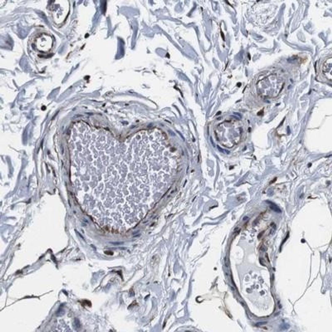 Immunohistochemistry-Paraffin: GJE1 Antibody [NBP2-14051] - Staining of human colon shows moderate positivity in endothelial cells and fibroblasts.