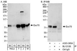 Detection of human and mouse Exo70 by western blot (h and m) and immunoprecipitation (h).