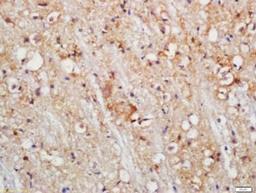 Immunohistochemical staining of Mouse brain tissue using PLDL1 antibody.