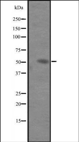 Western blot analysis of Hela cell lysate using IL6RA antibody