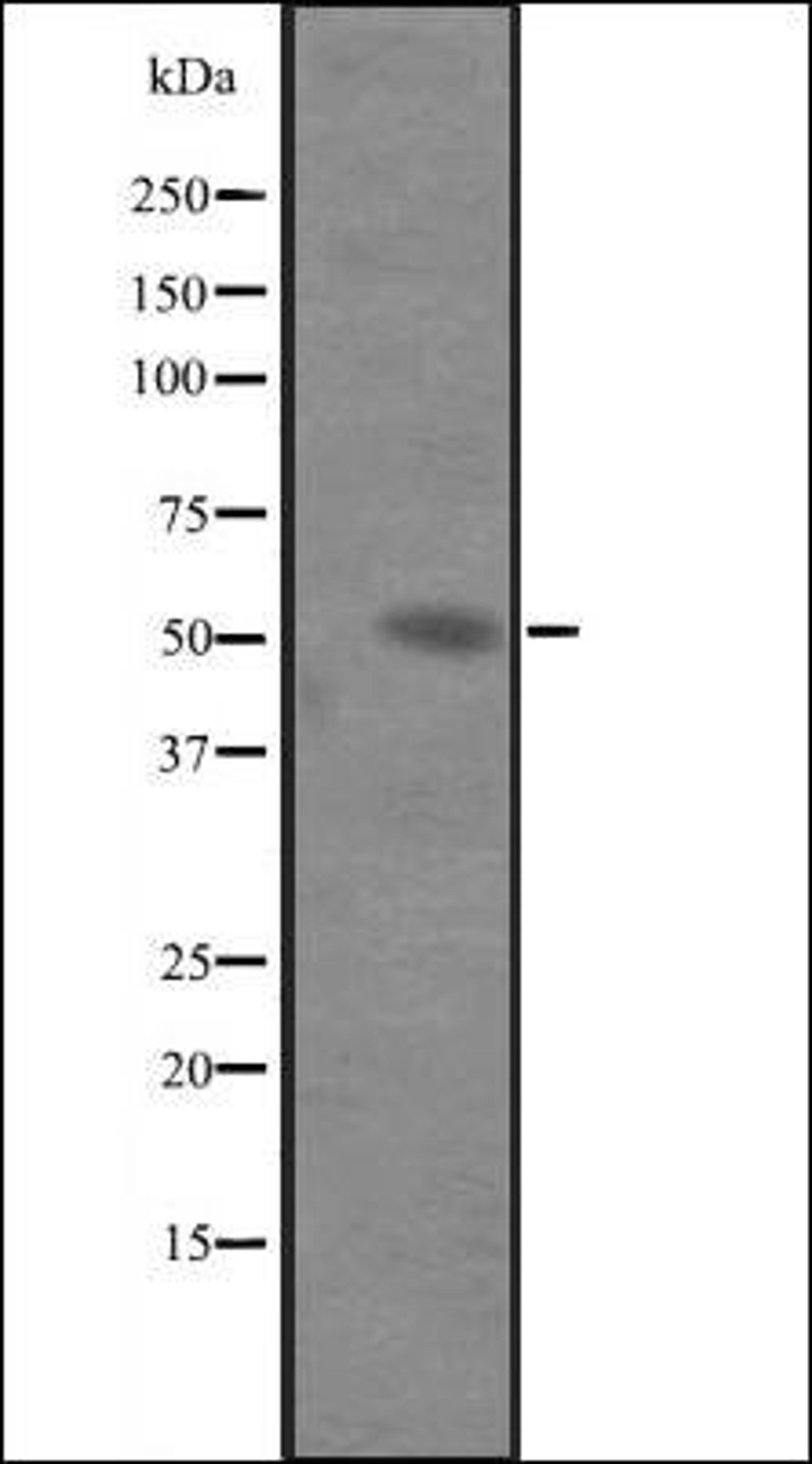 Western blot analysis of Hela cell lysate using IL6RA antibody