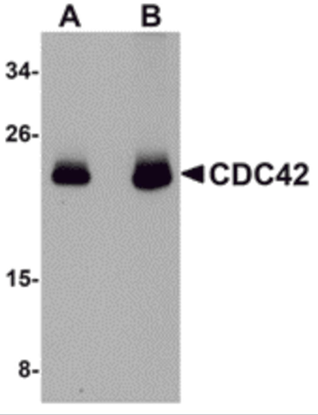 Western blot analysis of CDC42 in human brain tissue lysate with CDC42 antibody at (A) 0.5 and (B) 1 μg/mL.