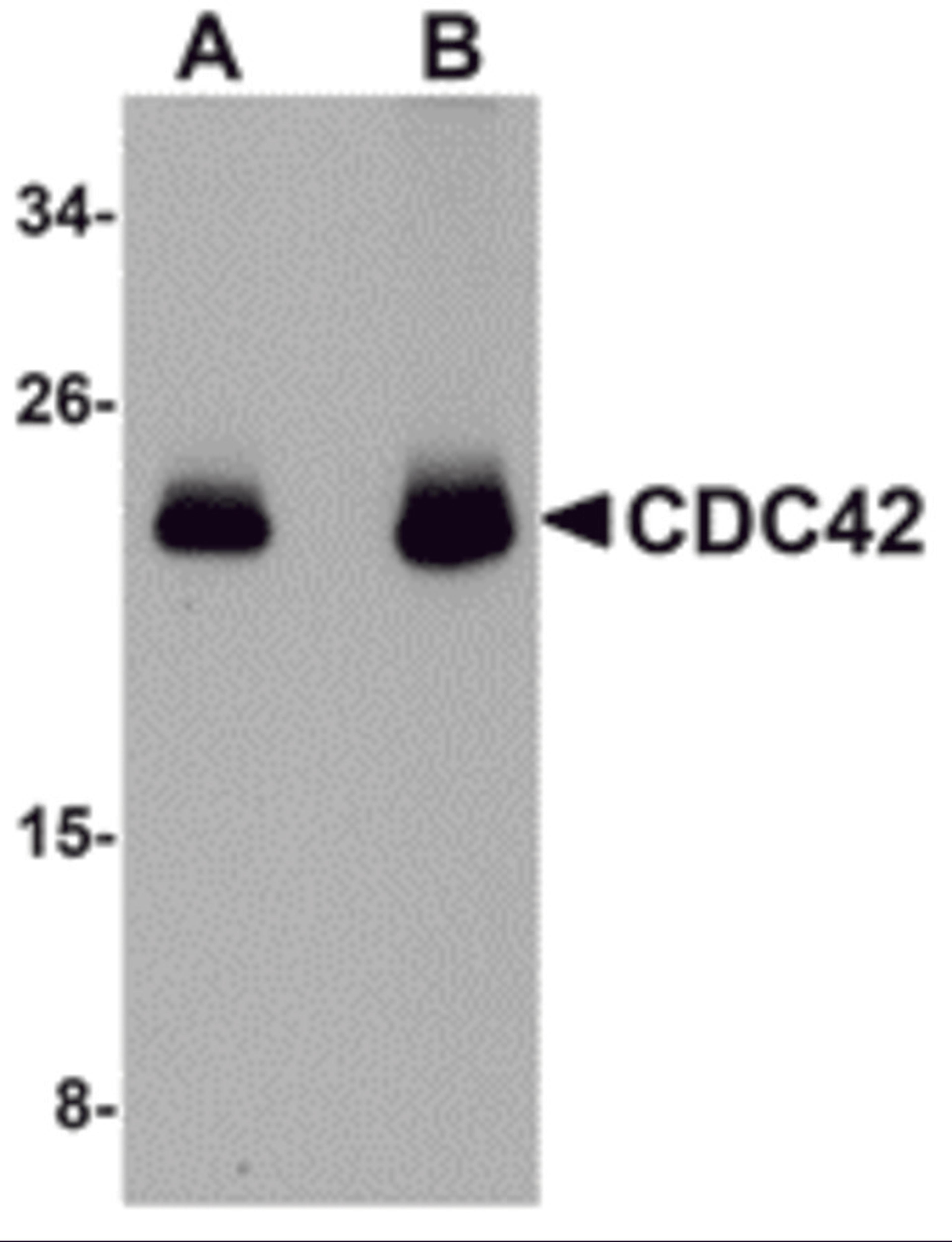 Western blot analysis of CDC42 in human brain tissue lysate with CDC42 antibody at (A) 0.5 and (B) 1 μg/mL.