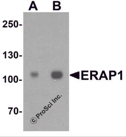 Western blot analysis of ERAP1 in SK-N-SH cell lysate with ERAP1 antibody at (A) 1 and (B) 2 &#956;g/ml.