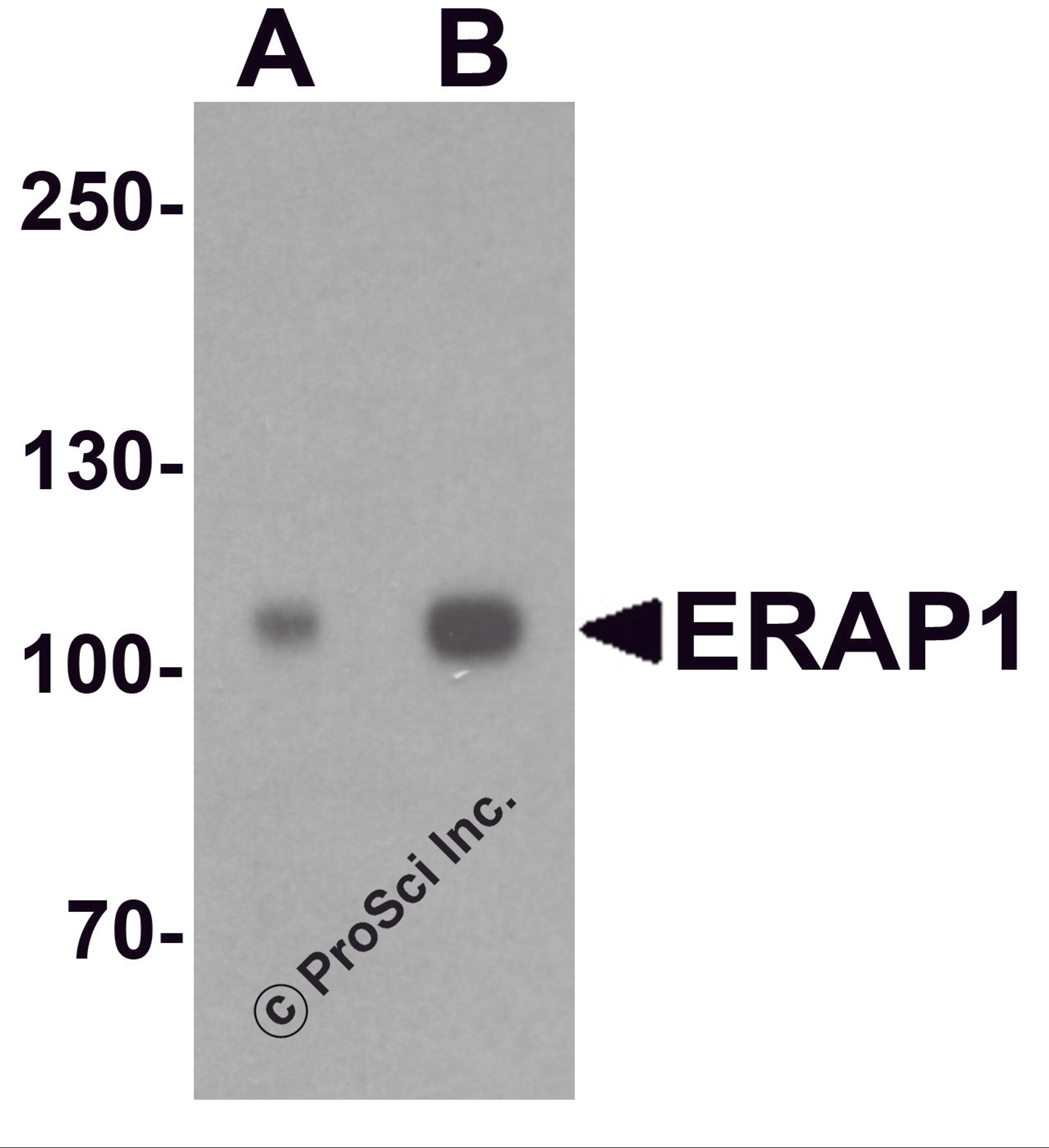 Western blot analysis of ERAP1 in SK-N-SH cell lysate with ERAP1 antibody at (A) 1 and (B) 2 μg/ml.