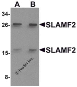 Western blot analysis of SLAMF2 in rat lung tissue lysate with SLAMF2 antibody at (A) 1 and (B) 2 &#956;g/mL.