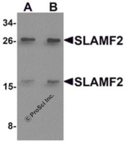 Western blot analysis of SLAMF2 in rat lung tissue lysate with SLAMF2 antibody at (A) 1 and (B) 2 μg/mL.