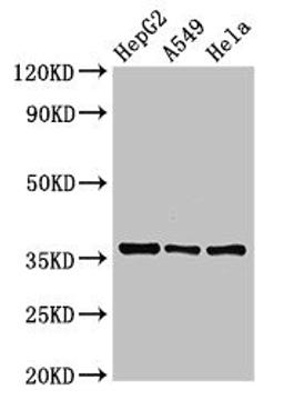 Western Blot. Positive WB detected in: HepG2 whole cell lysate, A549 whole cell lysate, Hela whole cell lysate. All lanes: ECH1 antibody at 2.5ug/ml. Secondary. Goat polyclonal to rabbit IgG at 1/50000 dilution. Predicted band size: 36 kDa. Observed band size: 36 kDa. 