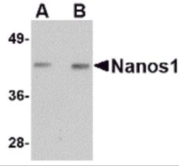 Western blot analysis of Nanos1 in rat brain tissue lysate with Nanos1 antibody at (A) 1 and (B) 2 &#956;g/mL.