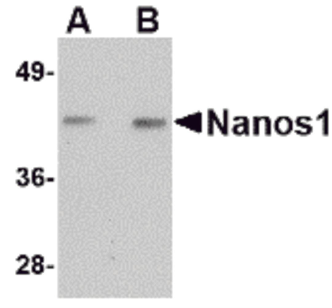 Western blot analysis of Nanos1 in rat brain tissue lysate with Nanos1 antibody at (A) 1 and (B) 2 μg/mL.