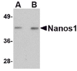 Western blot analysis of Nanos1 in rat brain tissue lysate with Nanos1 antibody at (A) 1 and (B) 2 μg/mL.
