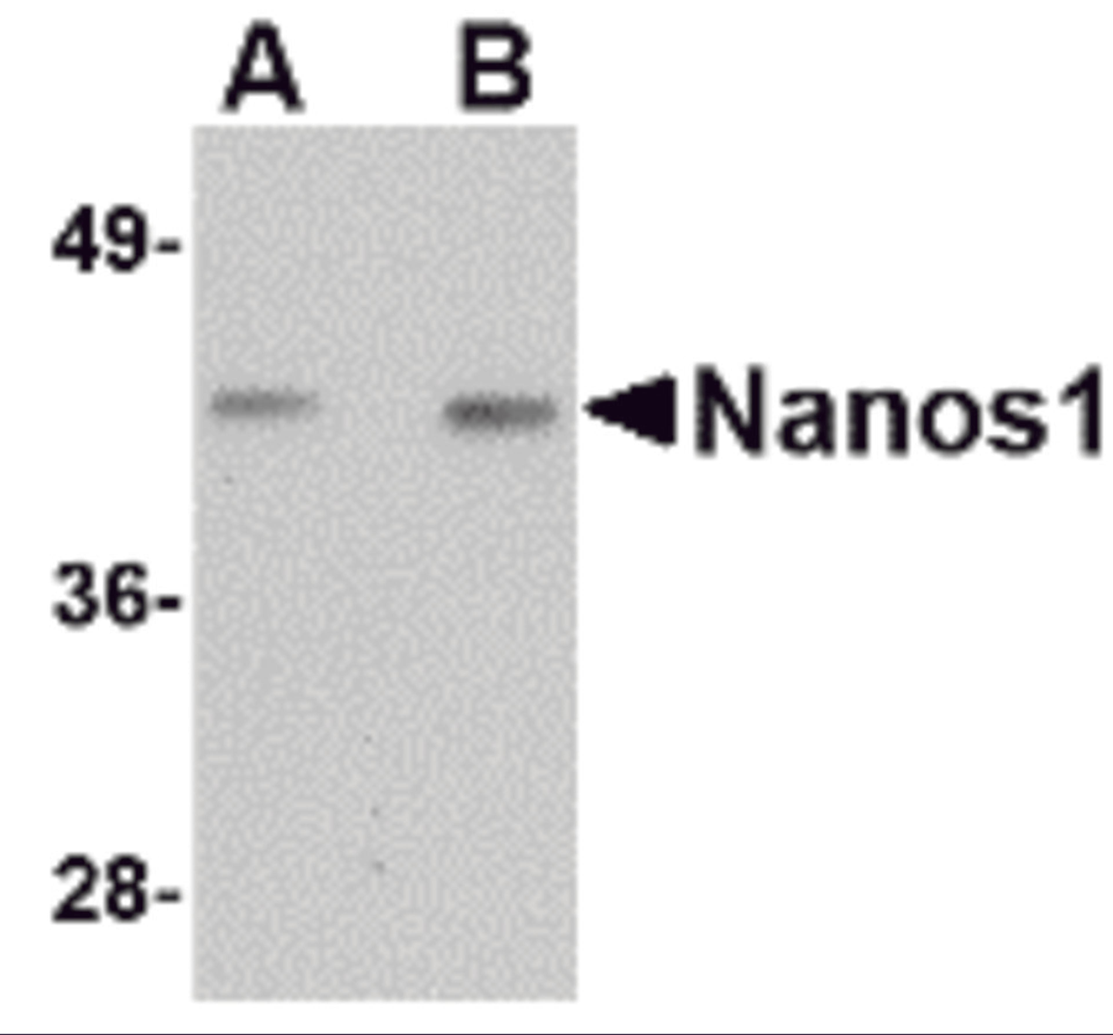 Western blot analysis of Nanos1 in rat brain tissue lysate with Nanos1 antibody at (A) 1 and (B) 2 μg/mL.