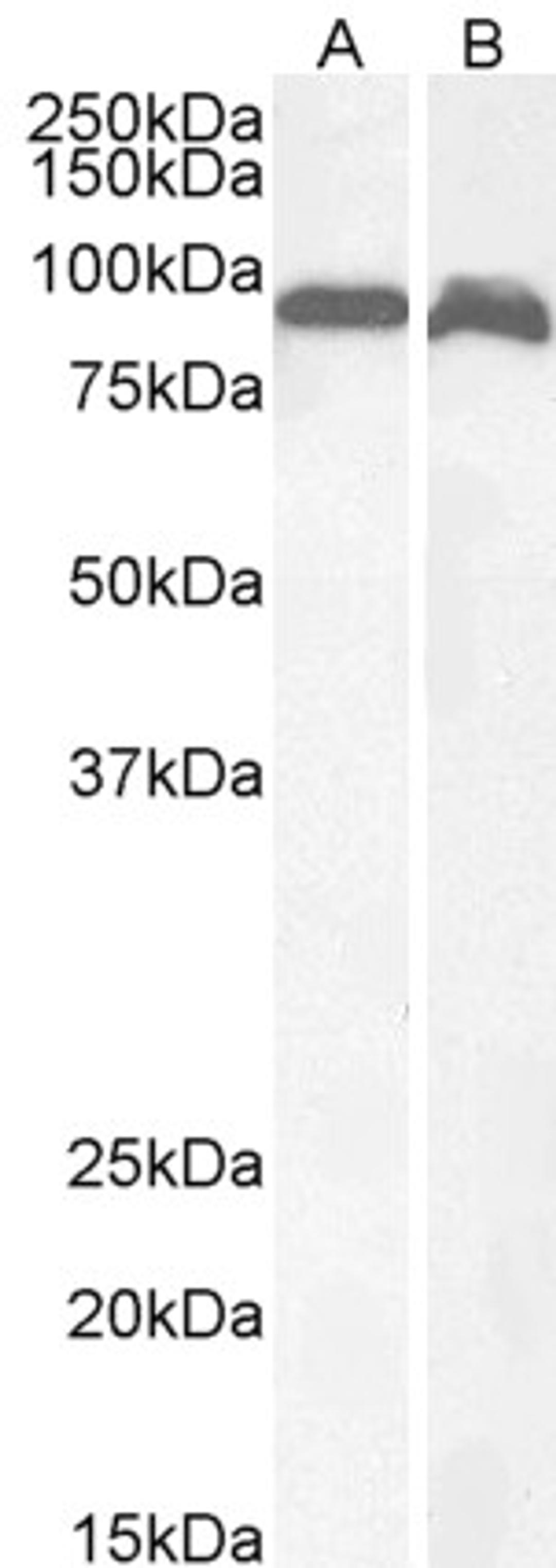 46-584 (1ug/ml) staining of Human Brain (Cerebellum) (A) and Rat Brain (B) lysates (35ug protein in RIPA buffer). Detected by chemiluminescence.