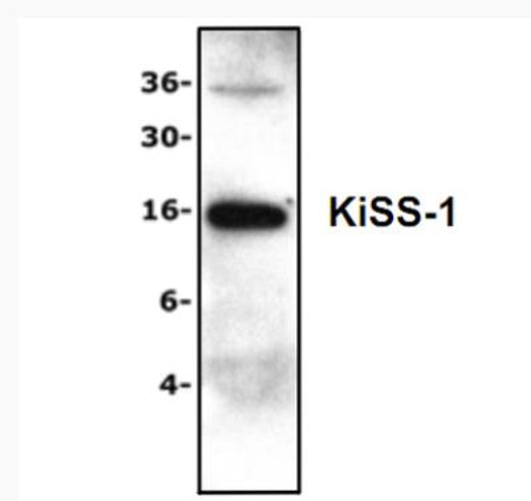 Western Blot: KISS1 Antibody [NBP1-45672] - Analysis of KiSS-1 expression with Jurkat Cell Lysate.