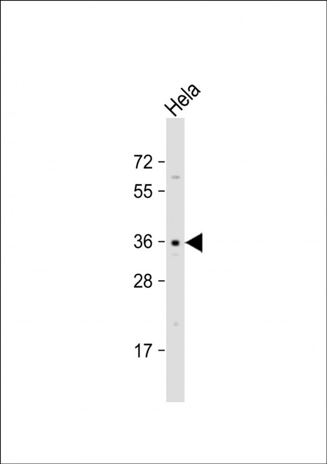 Western Blot at 1:1000 dilution + Hela whole cell lysate Lysates/proteins at 20 ug per lane.