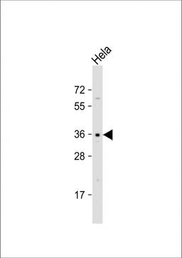 Western Blot at 1:1000 dilution + Hela whole cell lysate Lysates/proteins at 20 ug per lane.