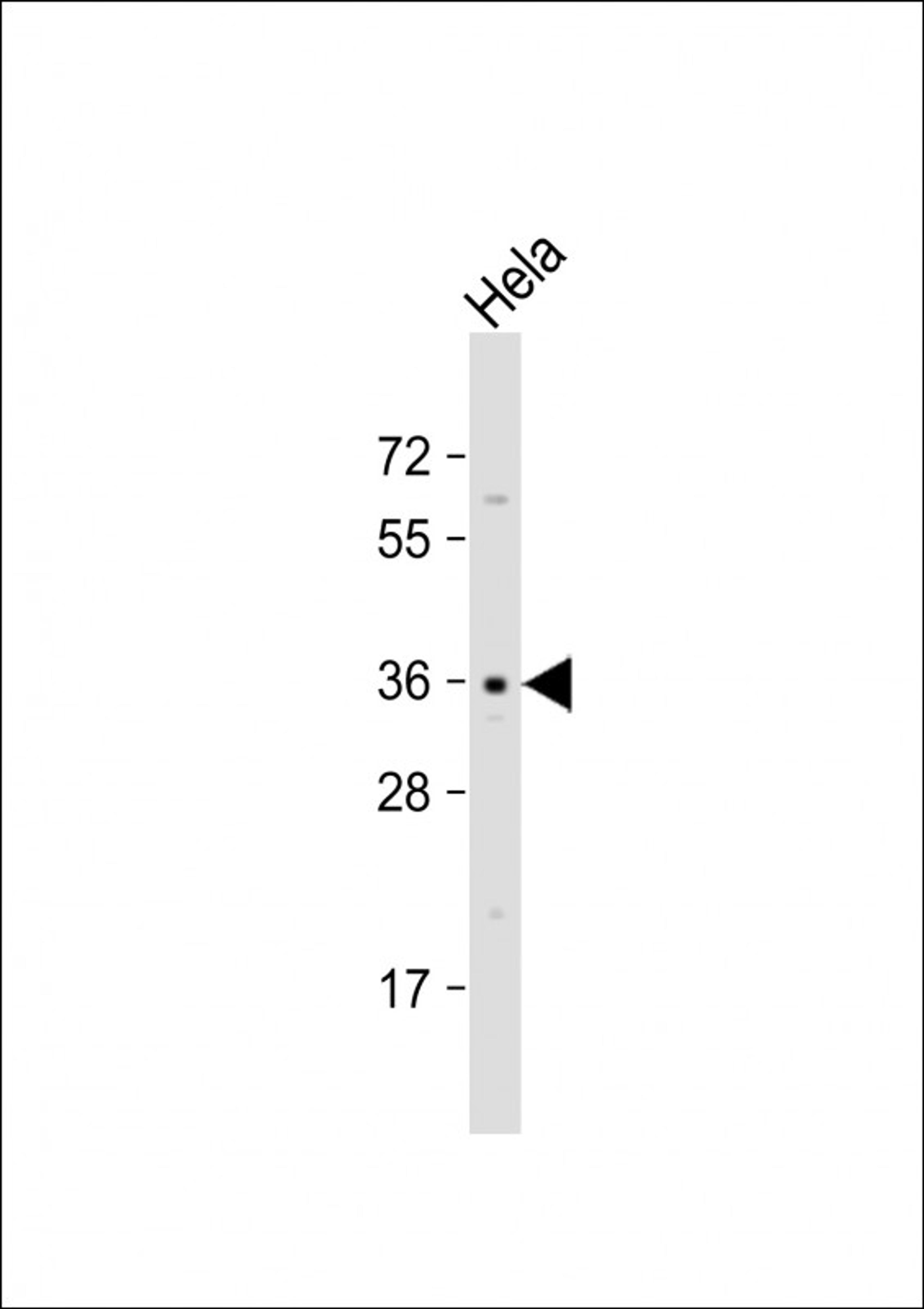 Western Blot at 1:1000 dilution + Hela whole cell lysate Lysates/proteins at 20 ug per lane.