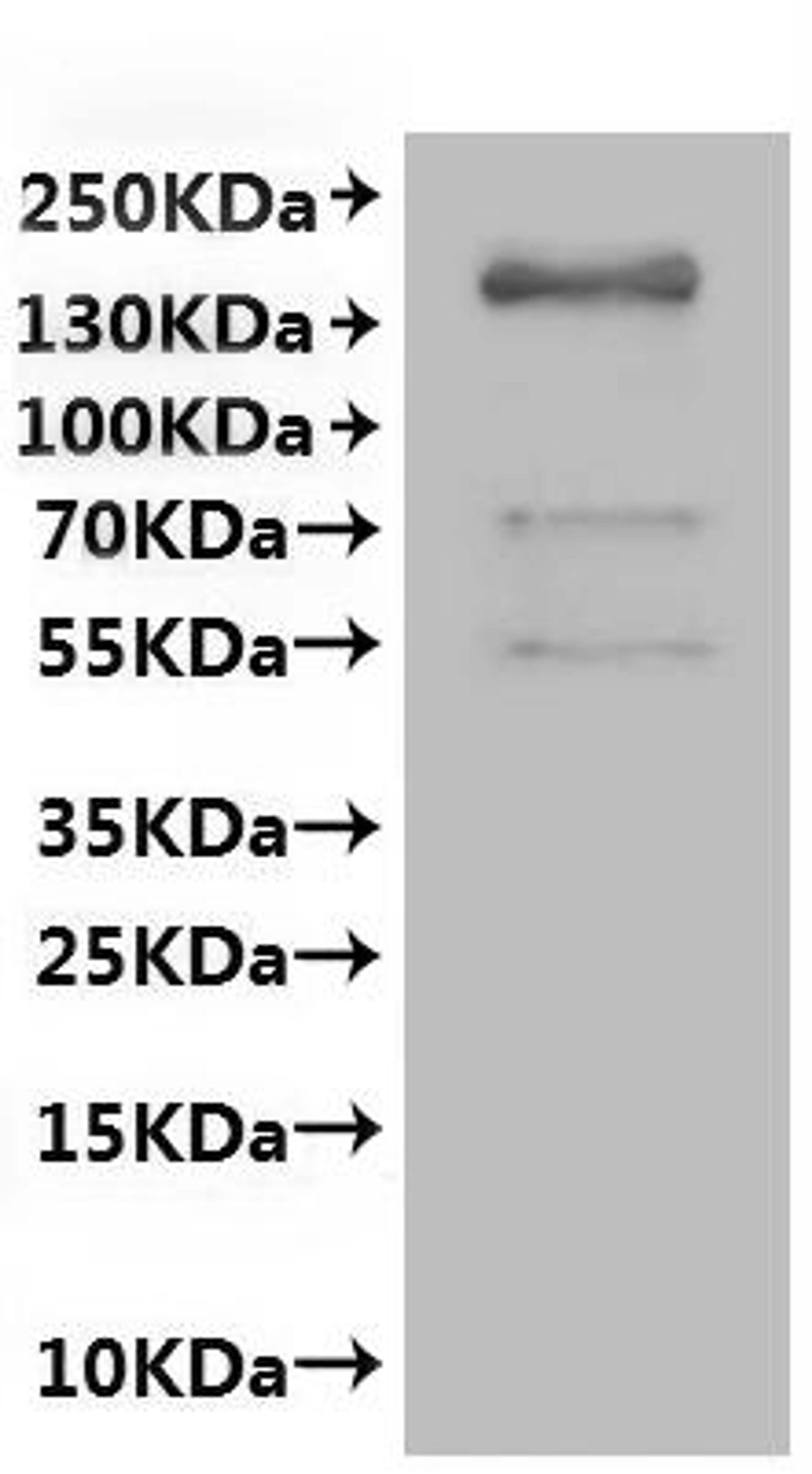 CSB-MP009448HUf4 is detected by Mouse anti-GFP monoclonal antibody.