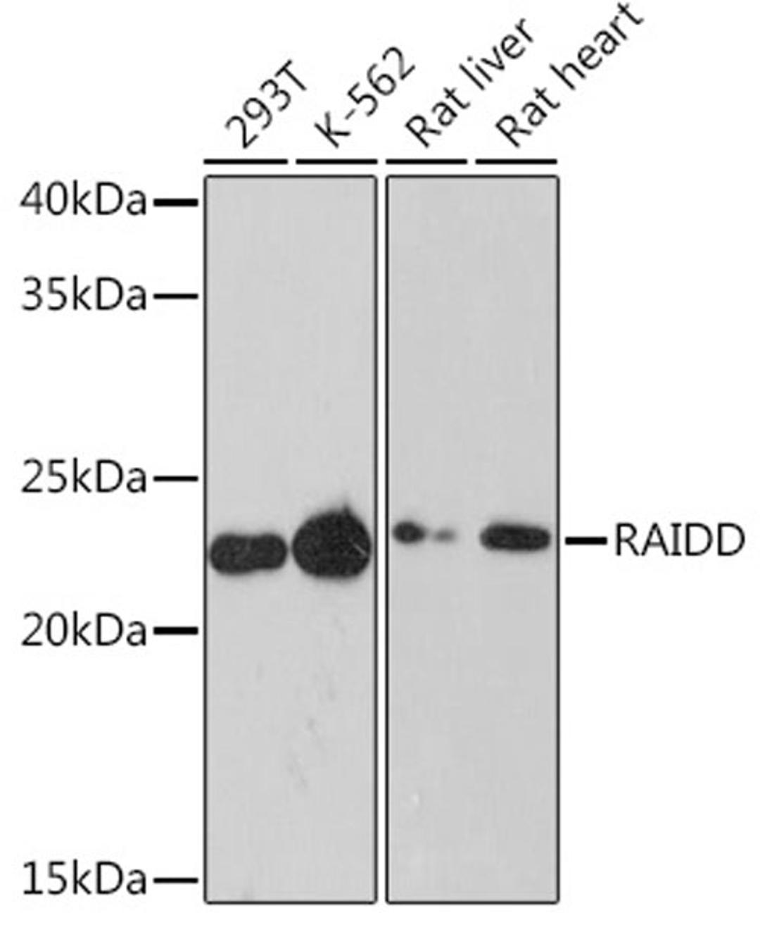 Western blot - RAIDD Rabbit mAb (A8664)