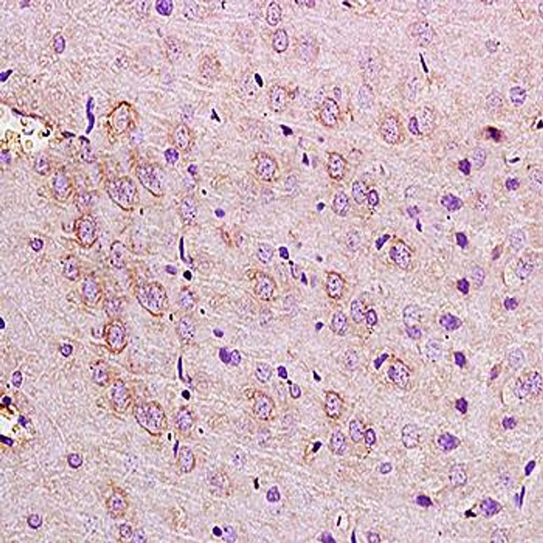 Immunohistochemical analysis of formalin-fixed and paraffin embedded rat brain tissue (dilution at:1:200) using NMDAR2D antibody