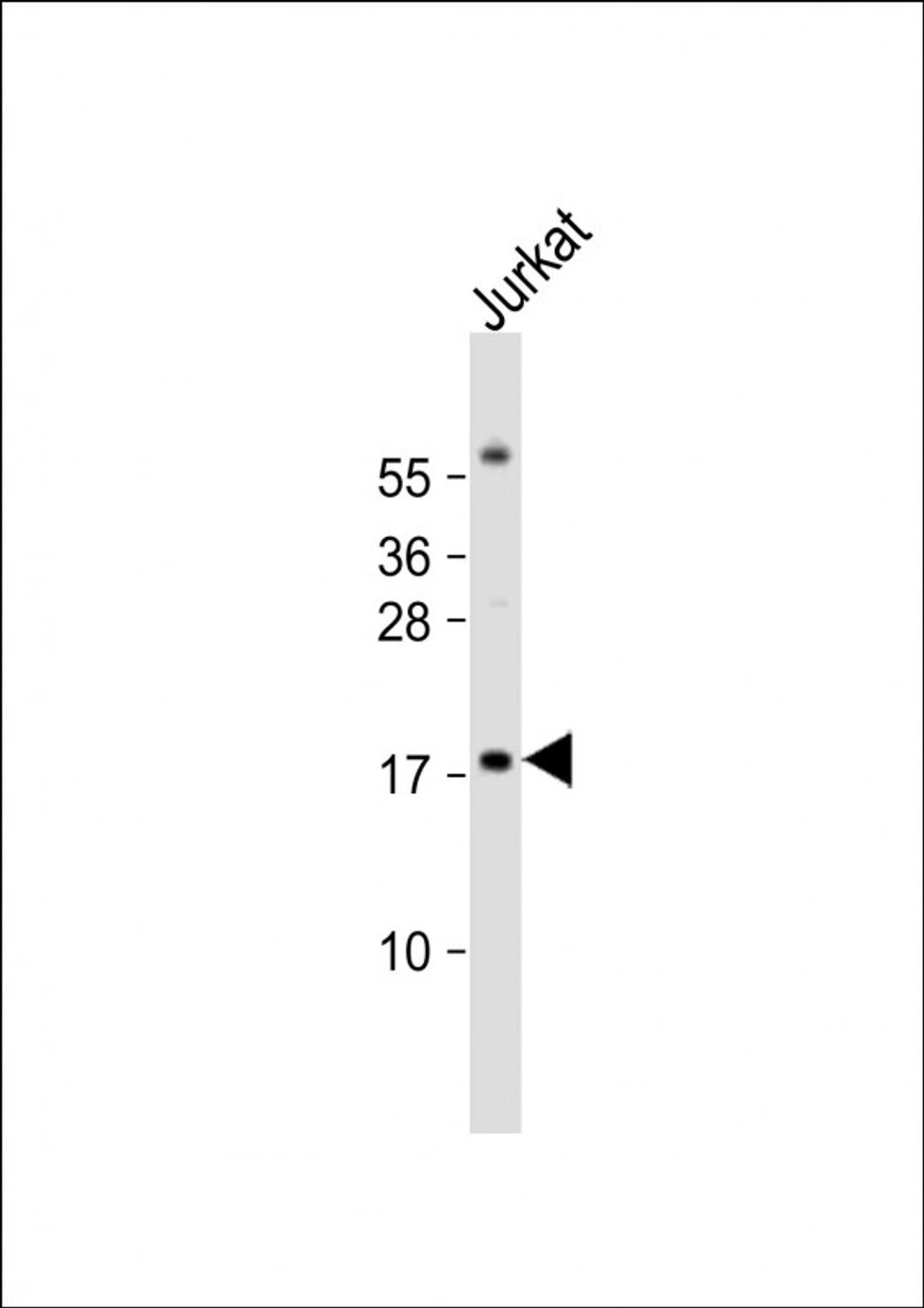 Western Blot at 1:1000 dilution + Jurkat whole cell lysate Lysates/proteins at 20 ug per lane.