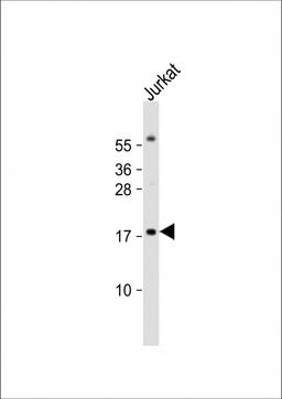 Western Blot at 1:1000 dilution + Jurkat whole cell lysate Lysates/proteins at 20 ug per lane.