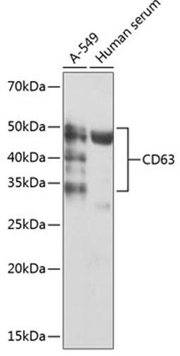 Western blot - CD63 antibody (A19023)