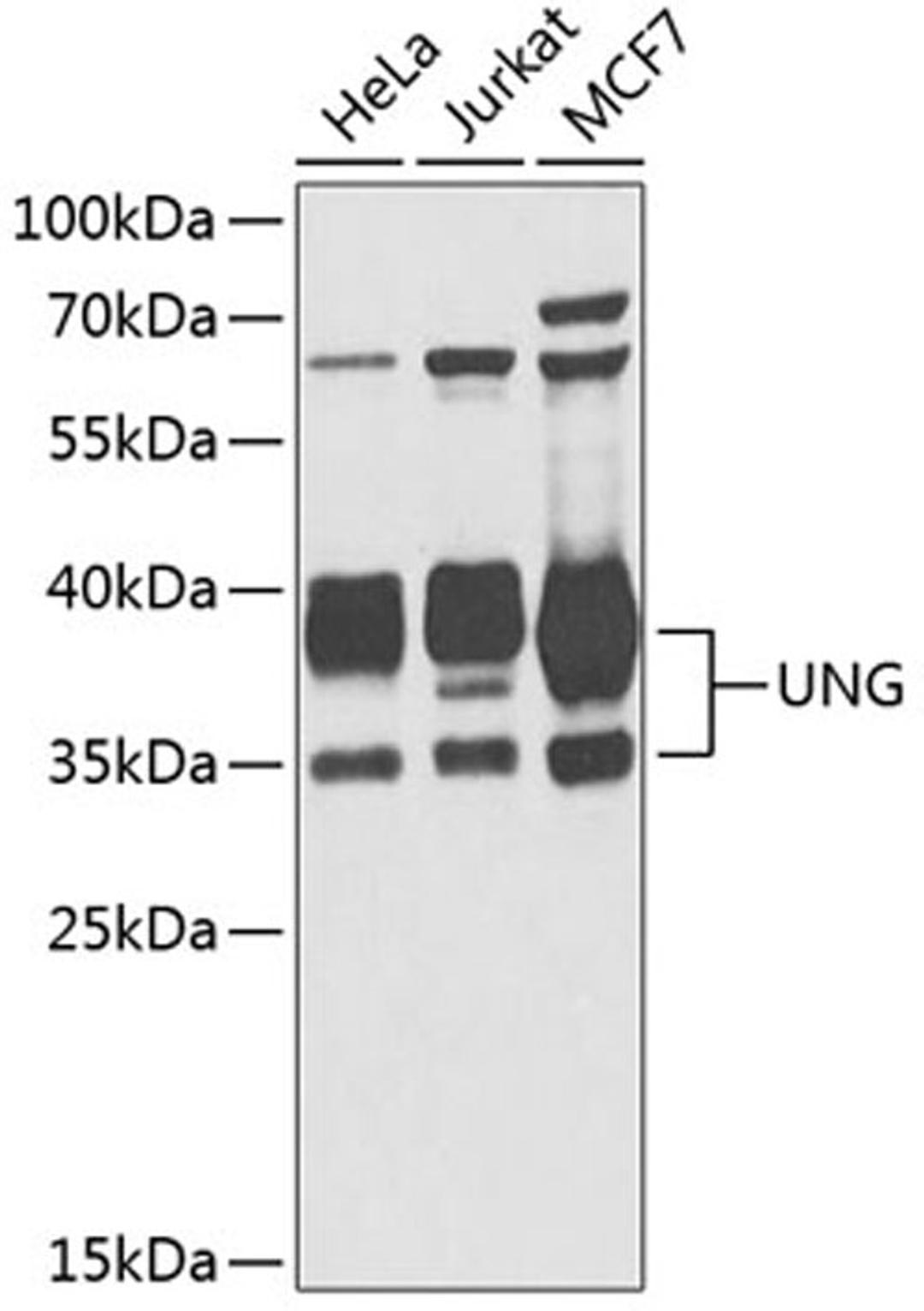 Western blot - UNG antibody (A1261)