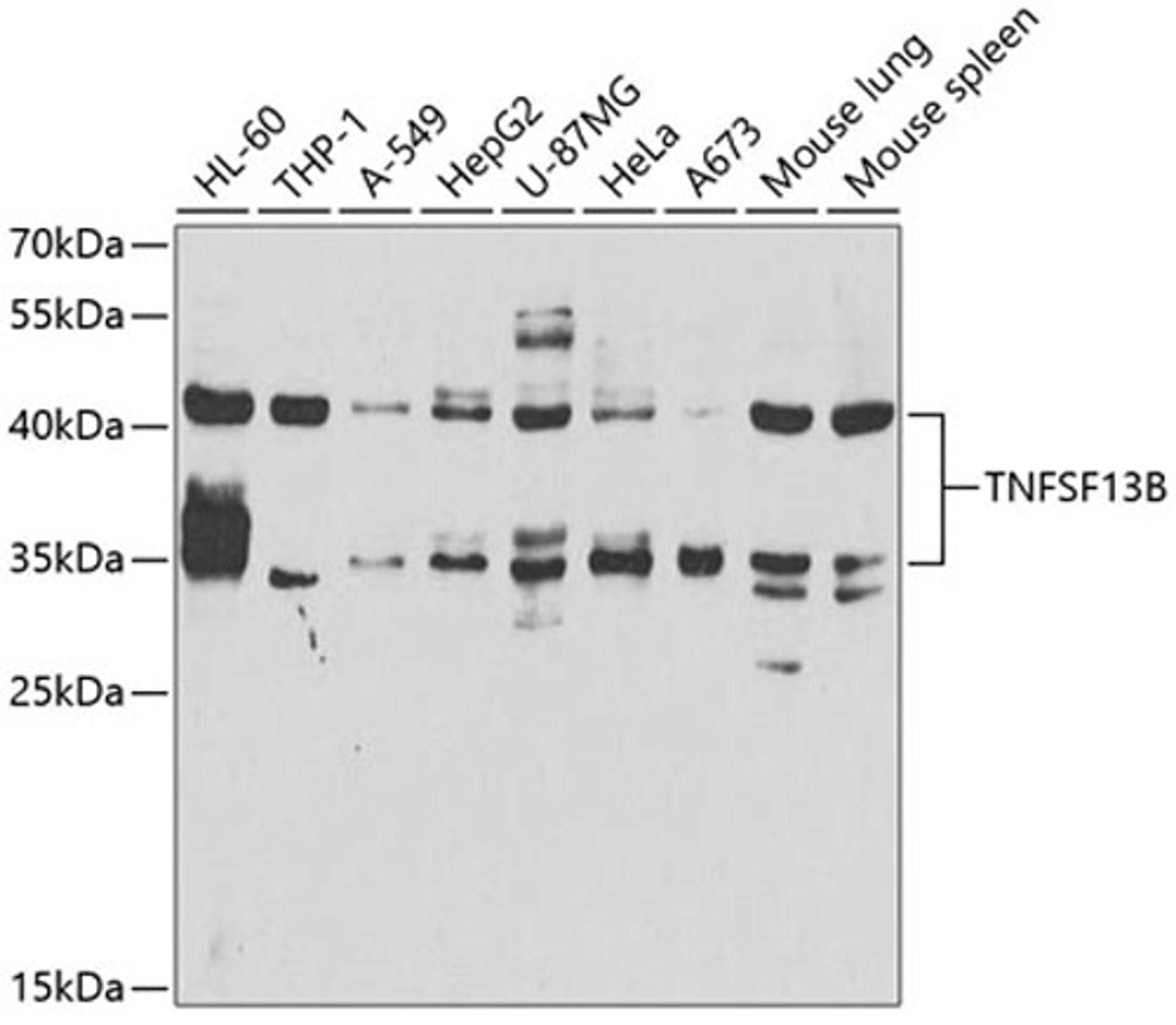 Western blot - TNFSF13B antibody (A5858)