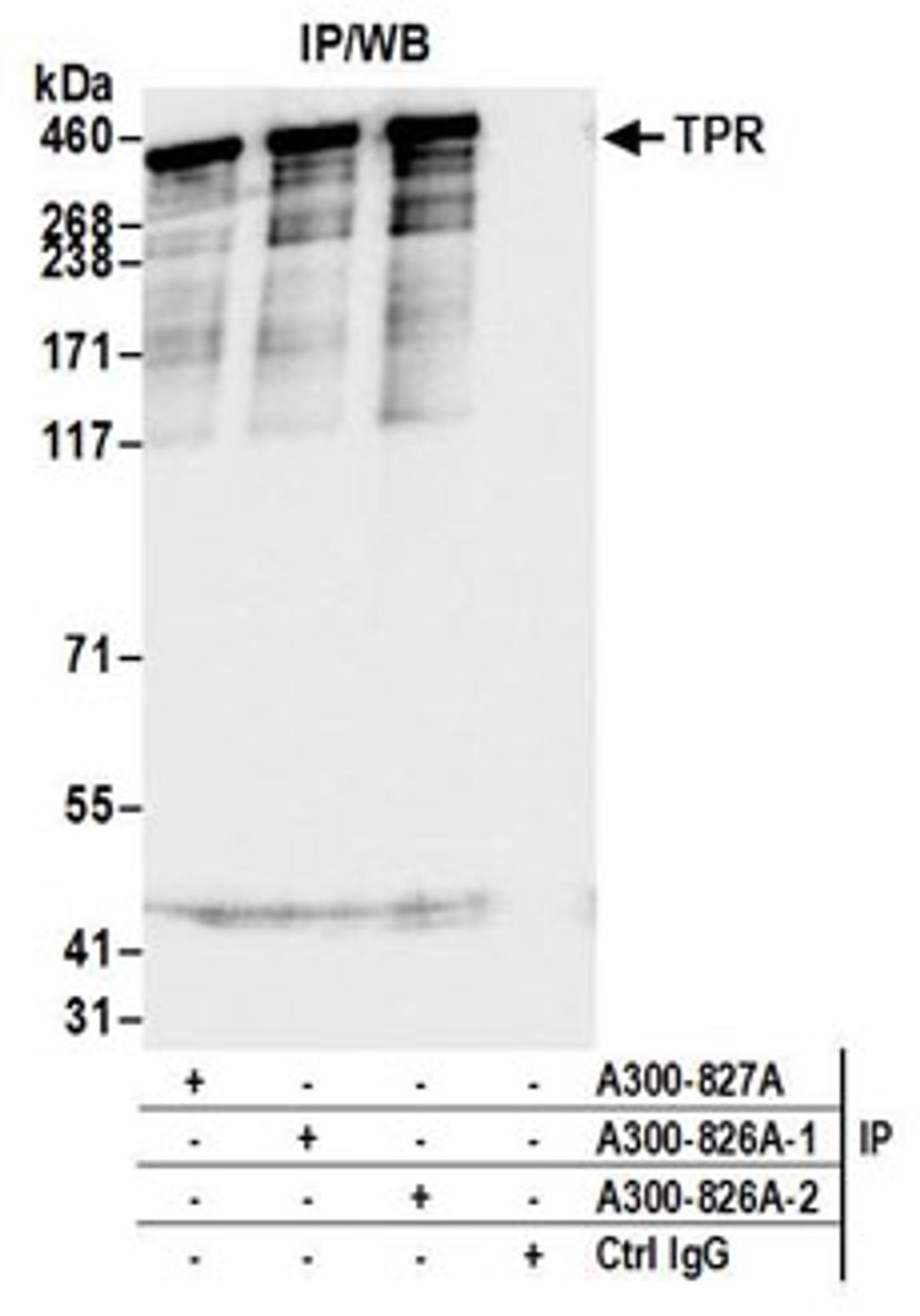 Detection of human TPR by western blot of immunoprecipitates.