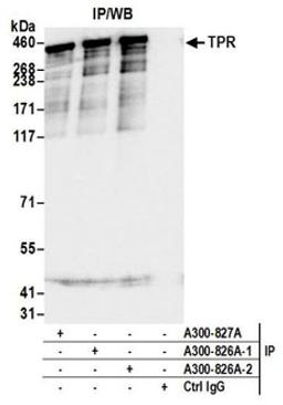 Detection of human TPR by western blot of immunoprecipitates.