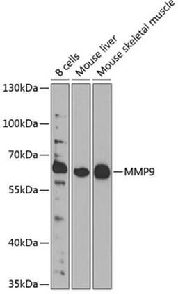 Western blot - MMP9 antibody (A11147)