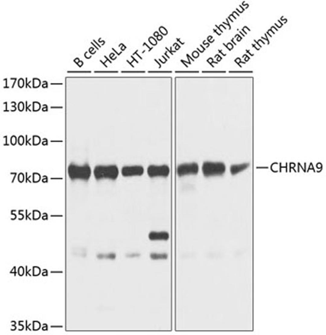 Western blot - CHRNA9 antibody (A9975)