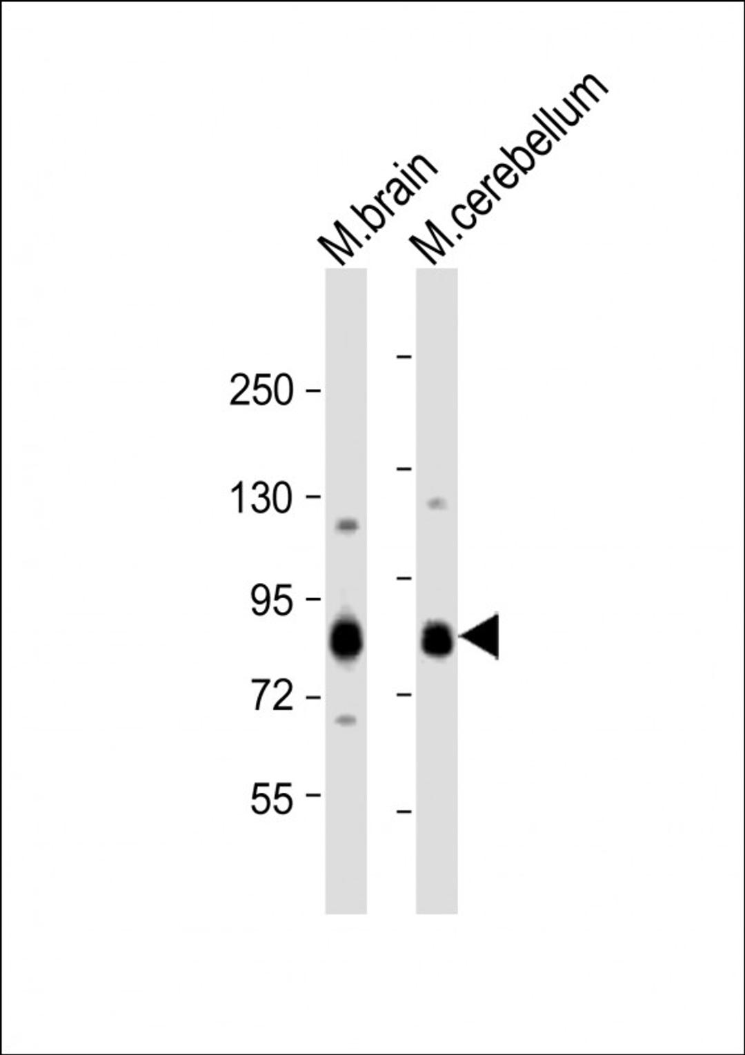 Western Blot at 1:1000 dilution Lane 1: mouse brain lysate Lane 2: mouse cerebellum lysate Lysates/proteins at 20 ug per lane.