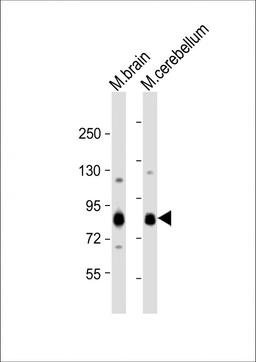 Western Blot at 1:1000 dilution Lane 1: mouse brain lysate Lane 2: mouse cerebellum lysate Lysates/proteins at 20 ug per lane.