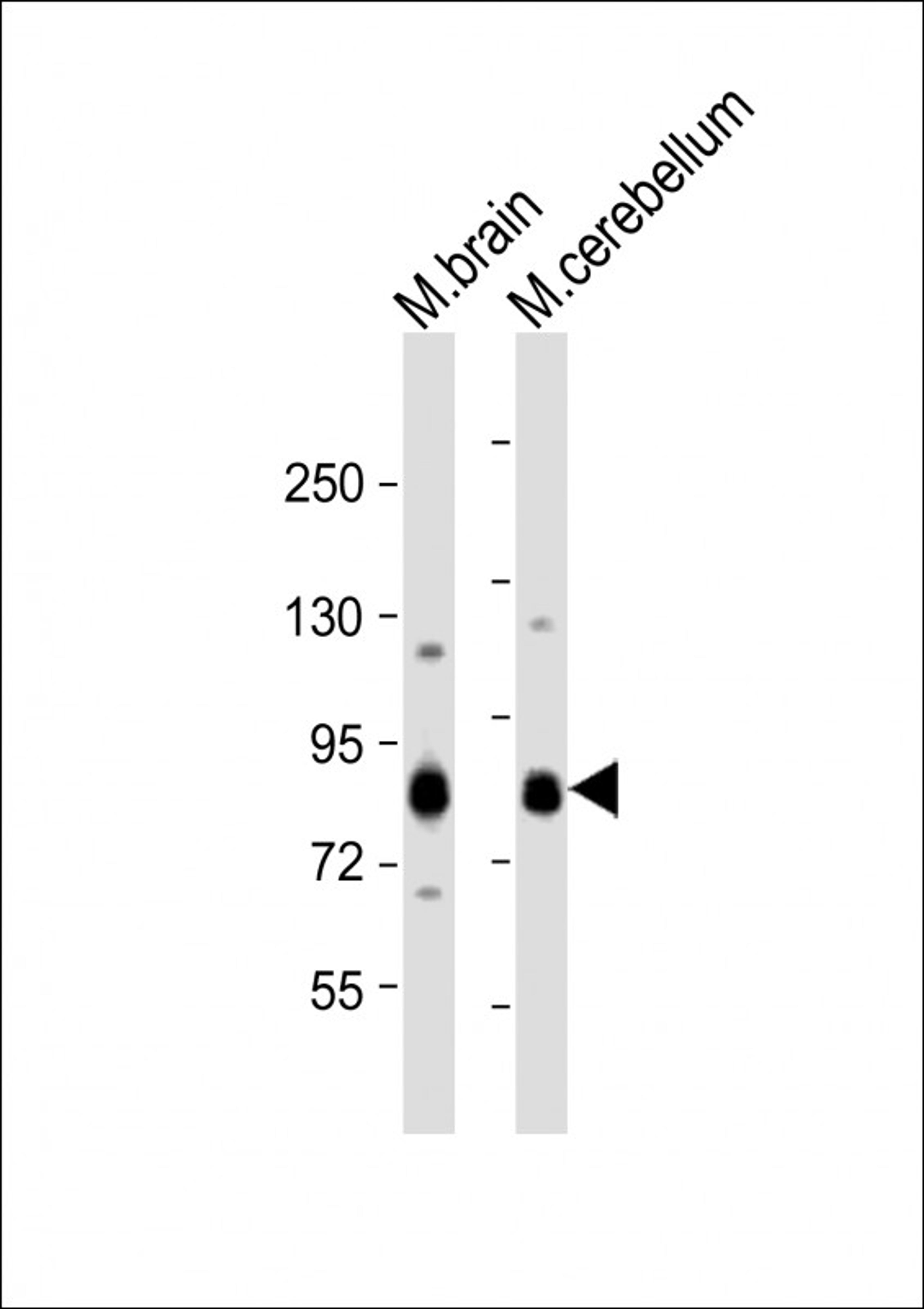 Western Blot at 1:1000 dilution Lane 1: mouse brain lysate Lane 2: mouse cerebellum lysate Lysates/proteins at 20 ug per lane.