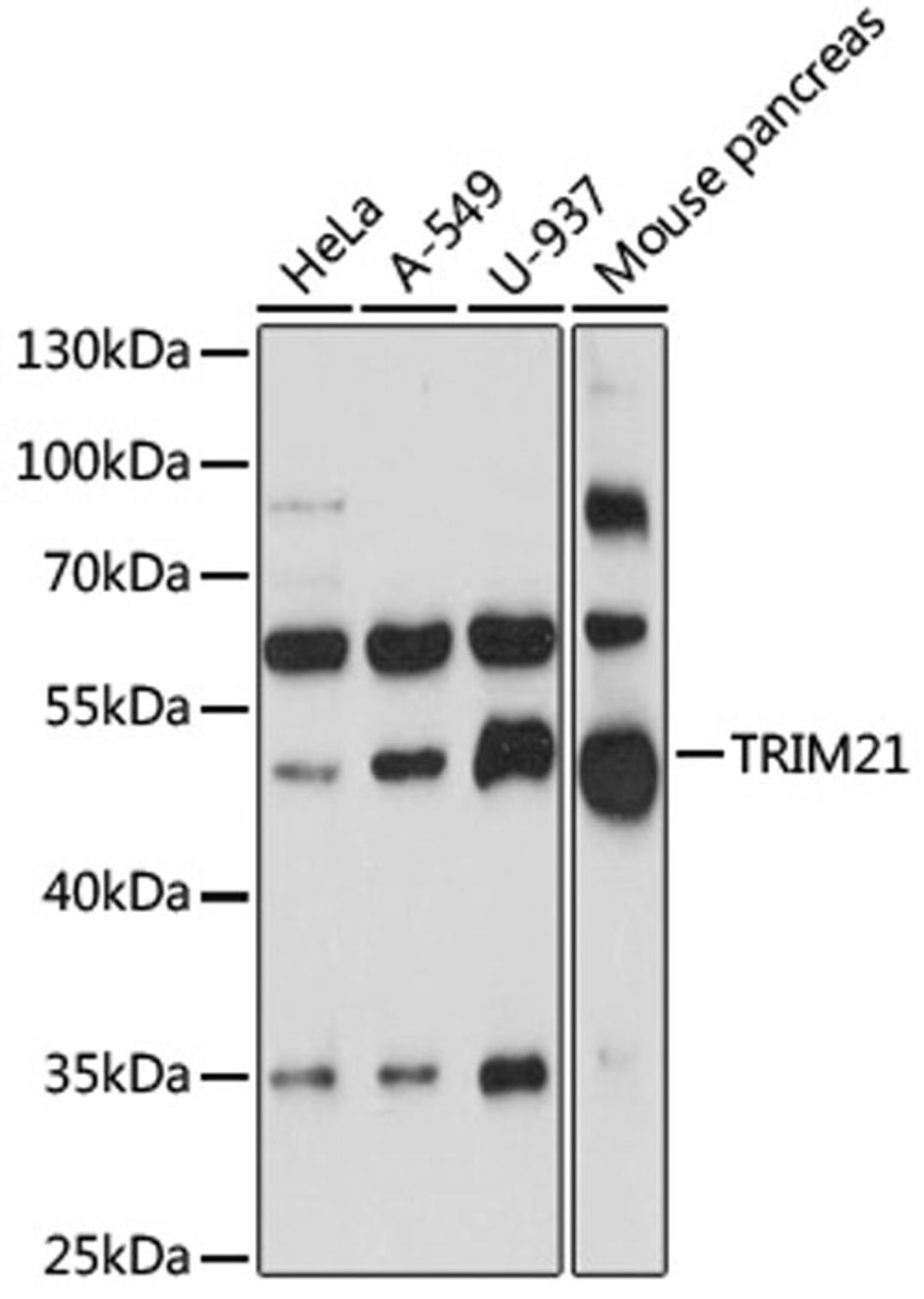 Western blot - TRIM21 antibody (A13547)