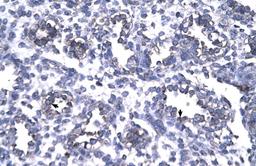 Antibody used in IHC on Human Lung.