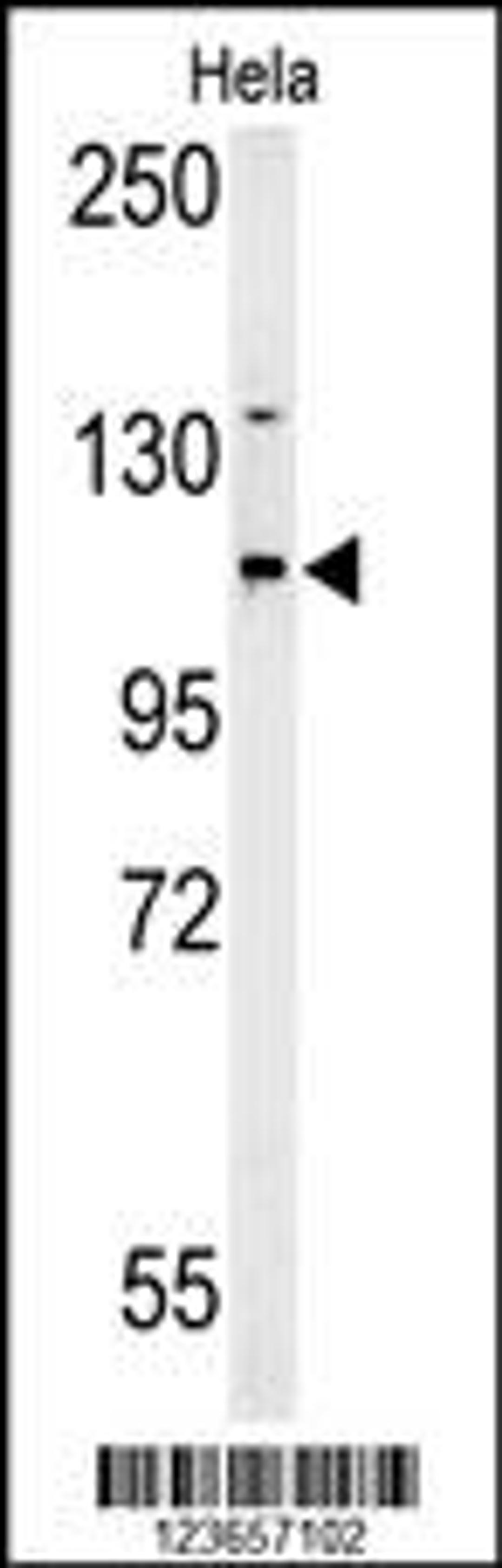 Western Blot in Hela cell line lysates (35ug/lane). ADCY4 (arrow) was detected using the purified Pab.