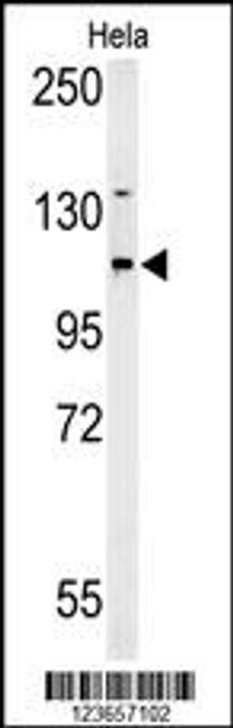 Western Blot in Hela cell line lysates (35ug/lane). ADCY4 (arrow) was detected using the purified Pab.